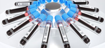 Test tubes filled with blood samples are neatly arranged in a circular pattern on a laboratory centrifuge.